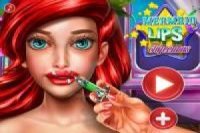 Ariel: Aumento de labios