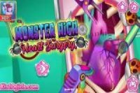 Monster High: chirurgie cardiaque